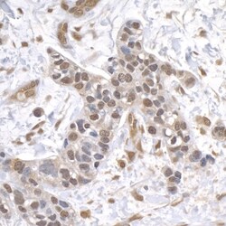 USP1 Antibody, Novus Biologicals 0.1mL; Unlabeled:Antibodies, Polyclonal